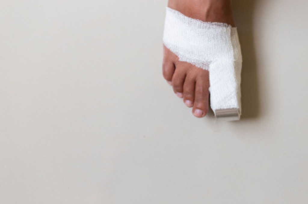 A Stubbed Toe Can Actually Be a Broken Toe