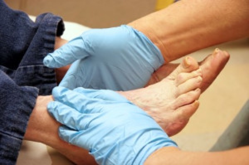 Foot Infections Linked to Diabetes
