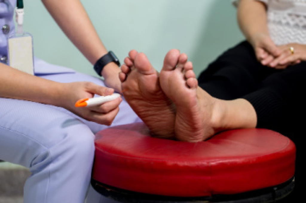Signs of Peripheral Neuropathy Begin in the Feet