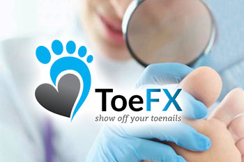 ToeFX Phototherapy for Onychomycosis